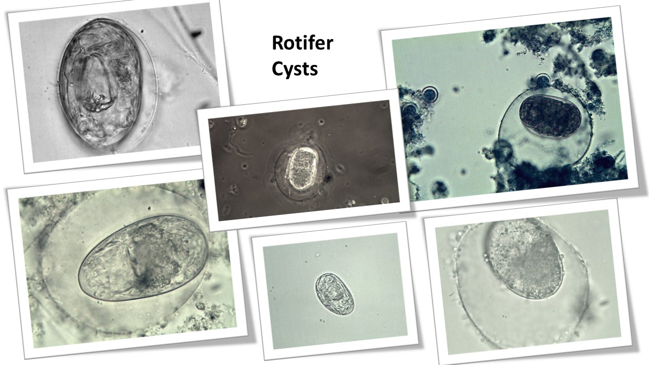 Rotifer cysts in Wastewater