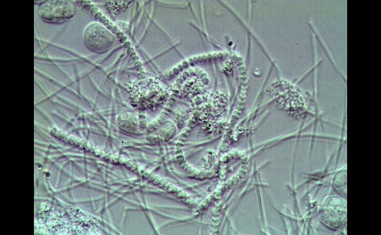 Filamentous Bacteria